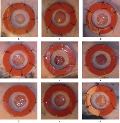 Automated <mark class="highlighted">wound care</mark> by employing a reliable U-Net architecture combined with ResNet feature encoders for monitoring chronic wounds